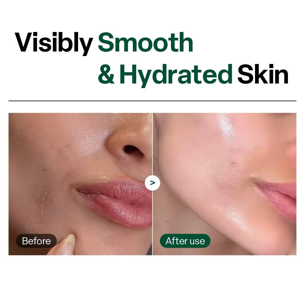 Dr. G Brightening Peeling Gel, Korean Skincare