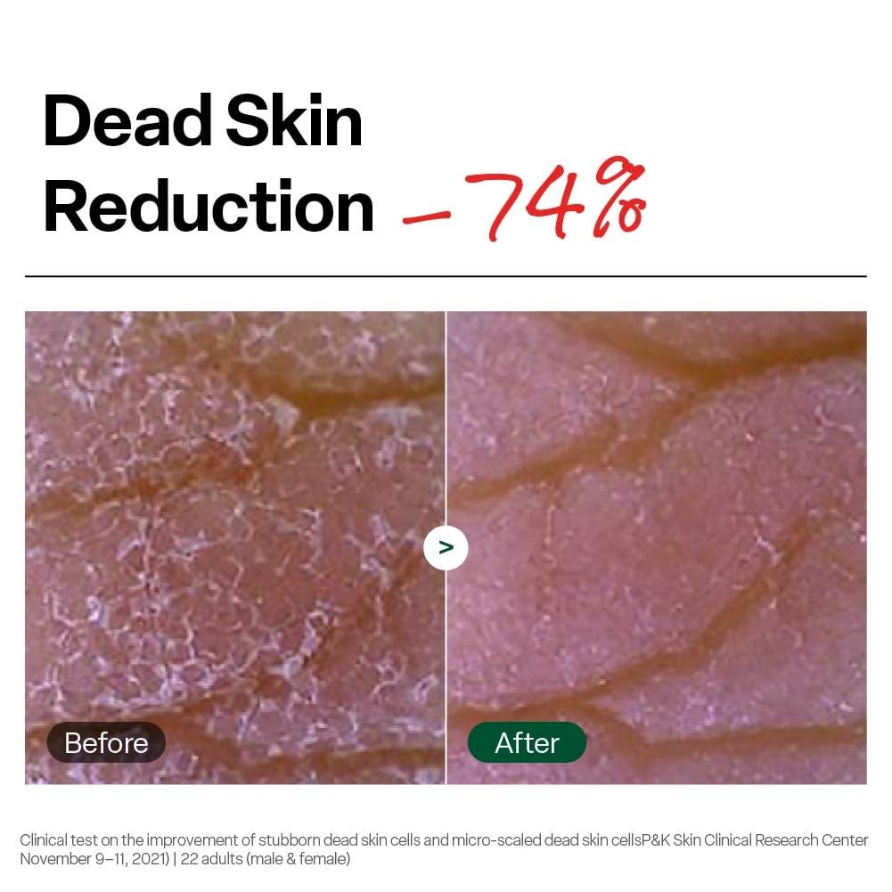 Dr. G Brightening Peeling Gel, Korean Skincare