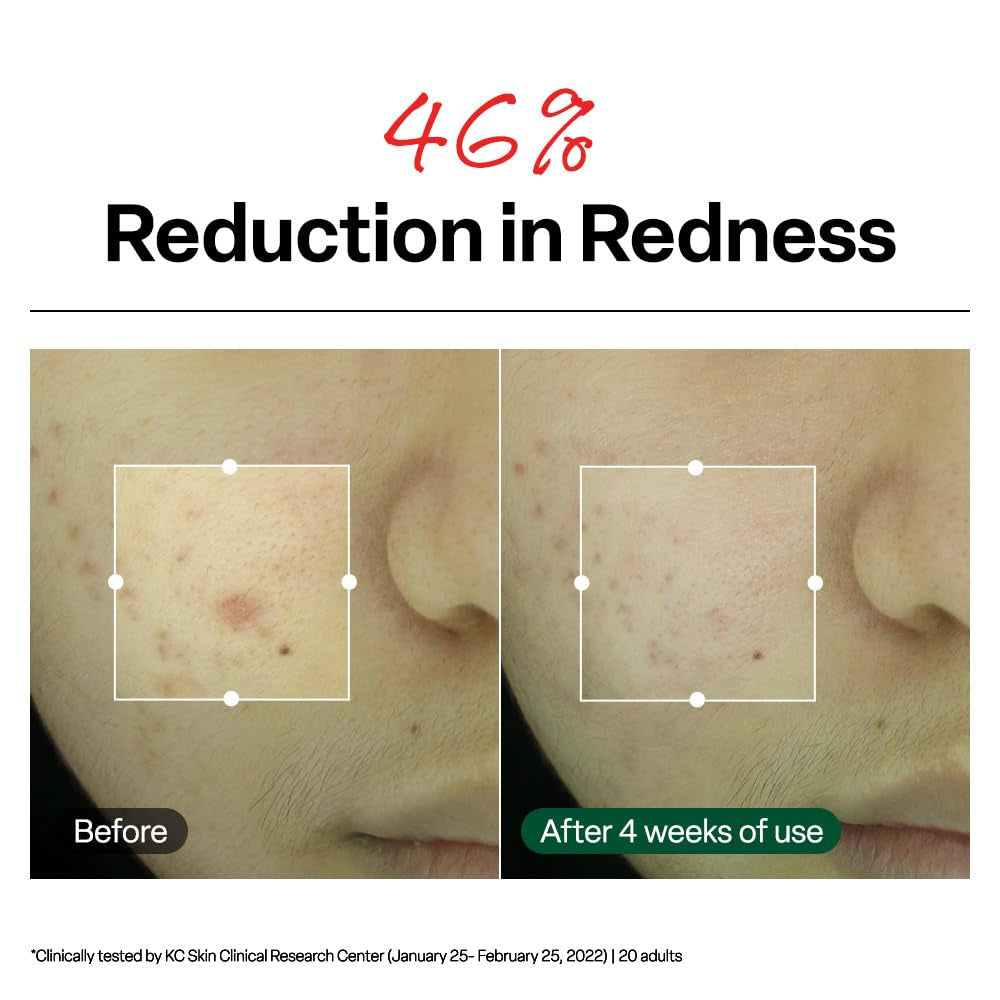 Dr.G R.E.D. Blemish Clear Soothing Face Cream, 2.36 Fl Oz